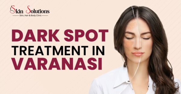 Dark Spot Treatment in Varanasi