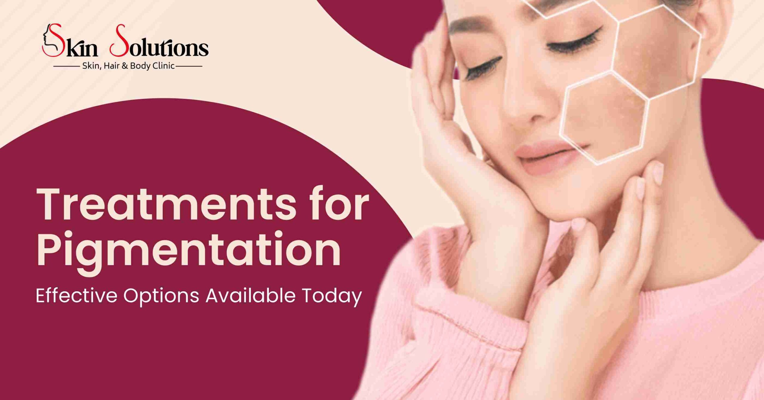 Hyperpigmentation Treatment in Varanasi