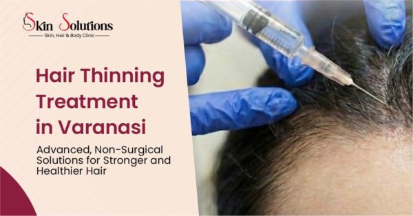 Hair Thinning Treatment in Varanasi