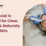 Hydra Facial in Varanasi