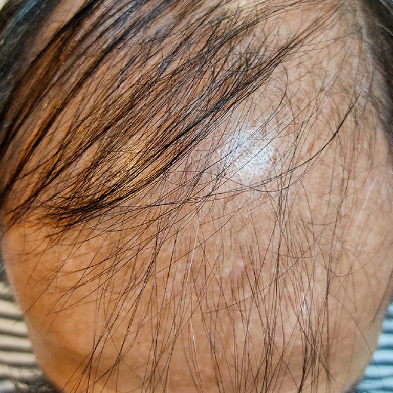 service hair treatment